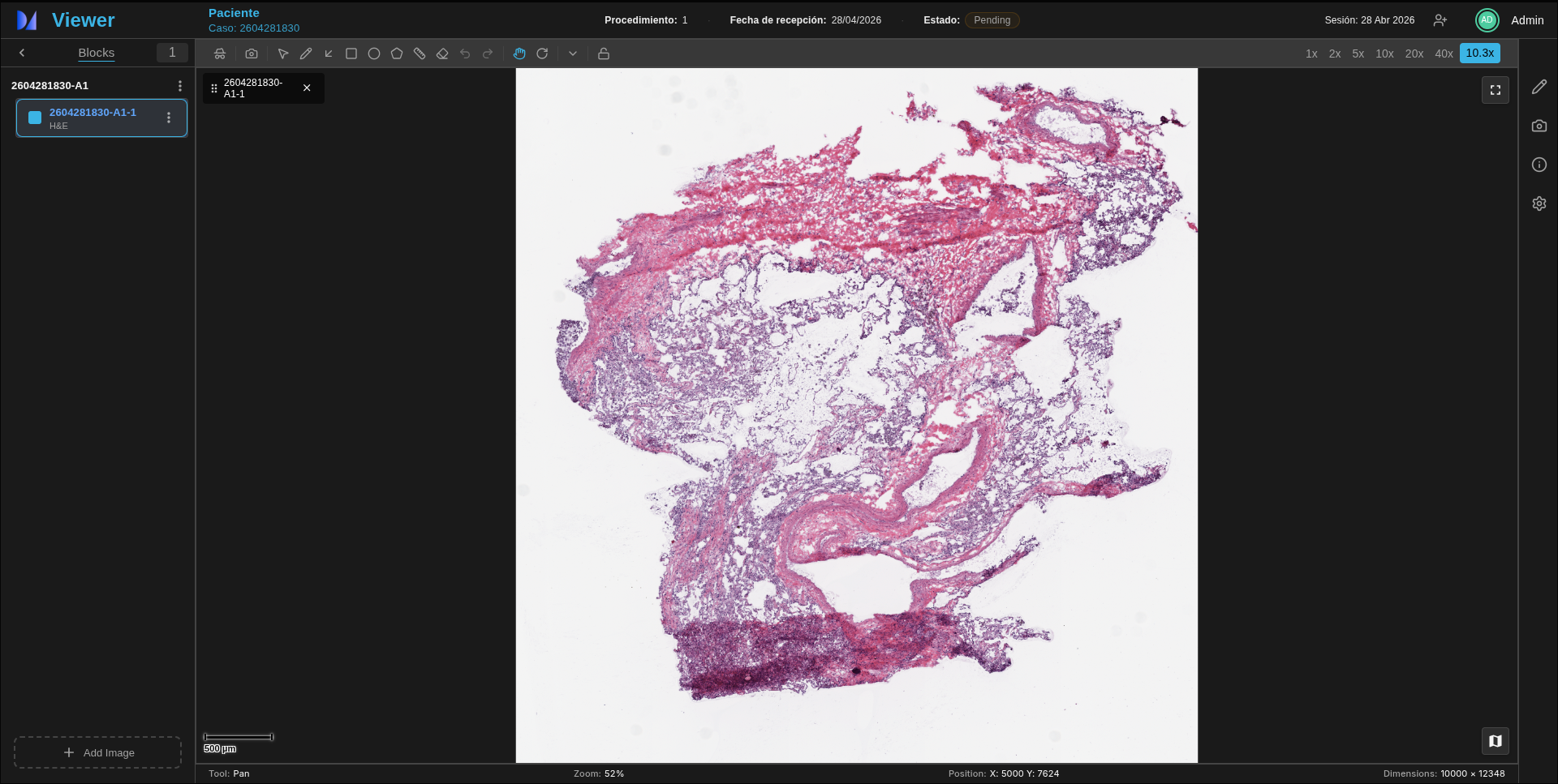 Aiscopia AI-powered digital pathology platform dashboard showing whole-slide image viewer and biopsy analysis tools